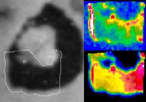 Loki Temperature Map